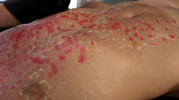 Two Sexy Dommes Torture Dude With Wax Screencap 27 on www.sinx.com